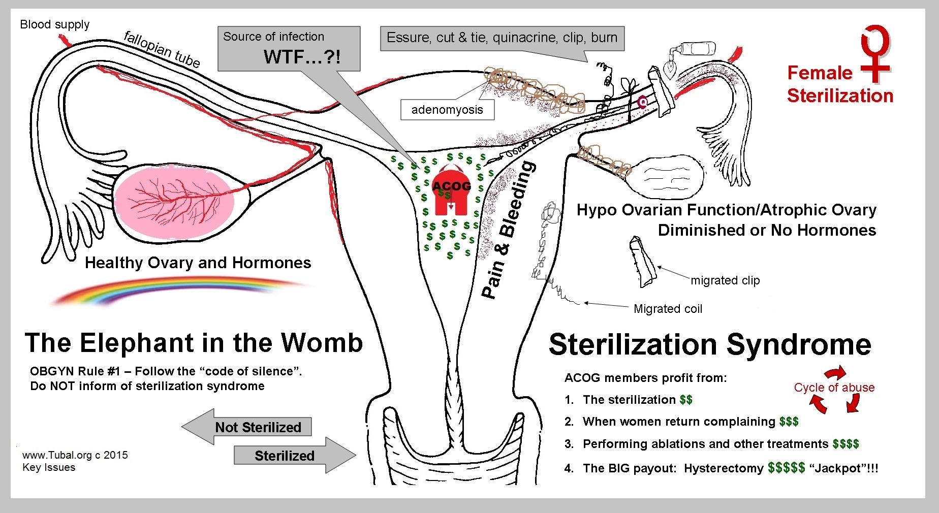 The elephant in the womb - Sterilization Syndrome