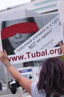 Tubal ligation informed consent is a right, NOT an option!