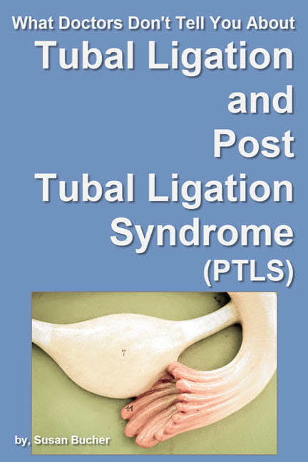 What Doctors Don't Tell You About Tubal Ligation and Post Tubal Ligation Syndrome (PTLS)